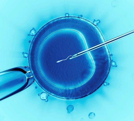 什么是体外受精（IVF）？试管婴儿又是什么？